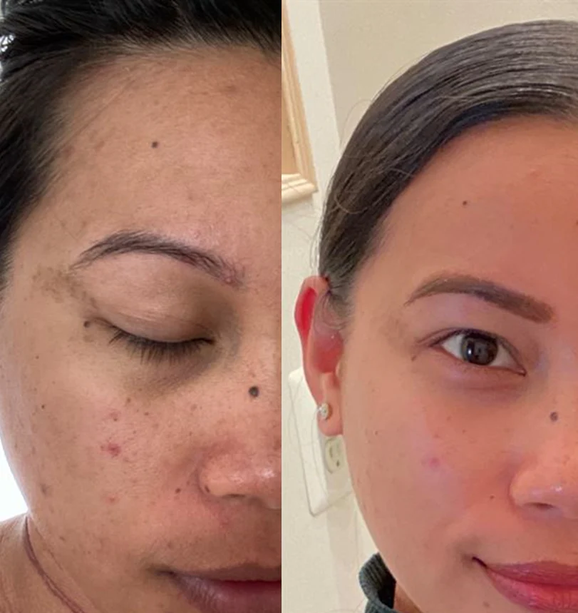 Deep Vita C Capsule Serum 30ml - Image 4