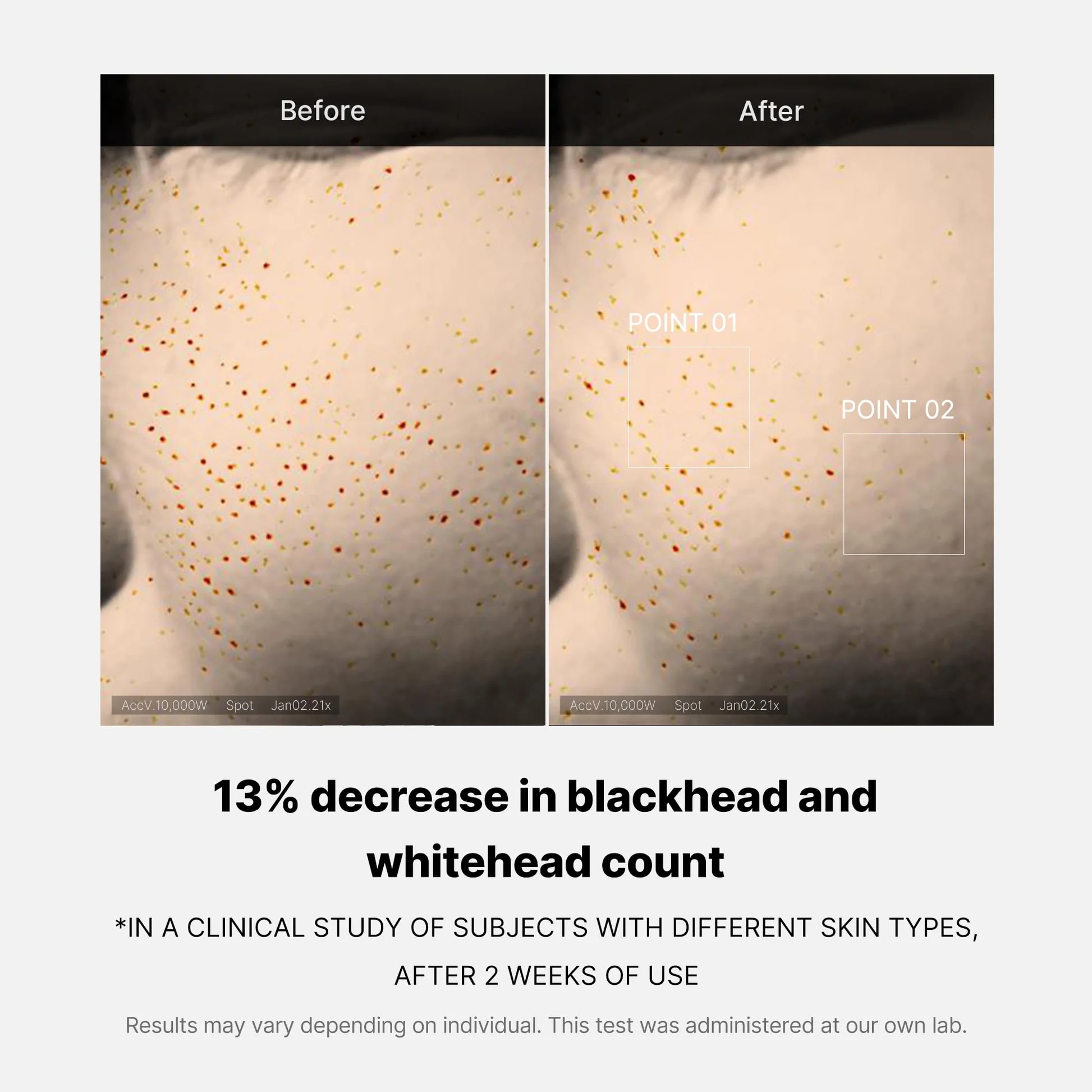 Medicube Zero Pore One Day Serum 30ml - Image 6